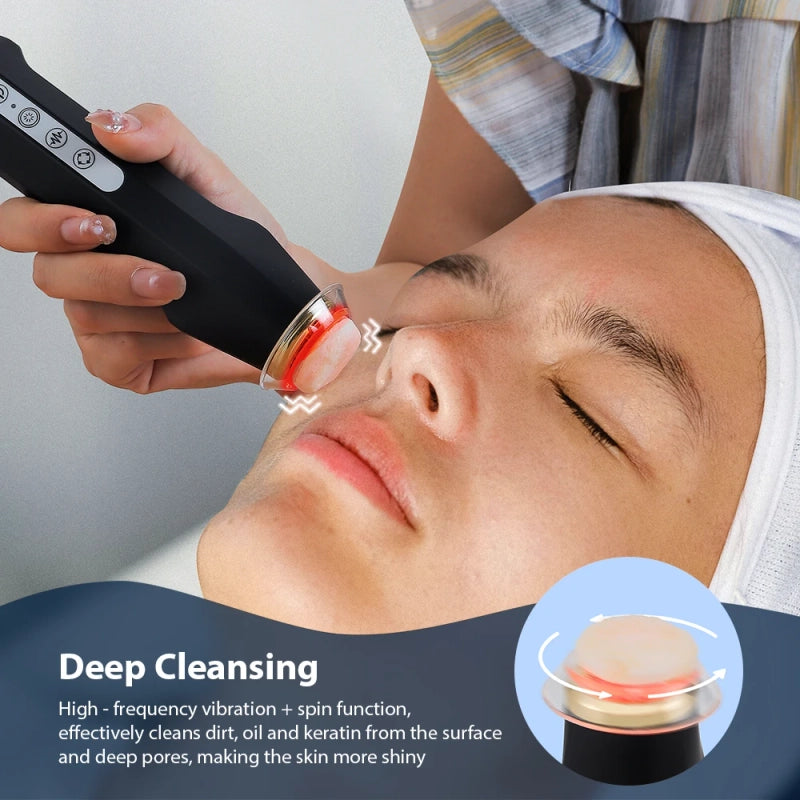 Oxygen Bubble Facial Pen — At-Home Hydrafacial Device