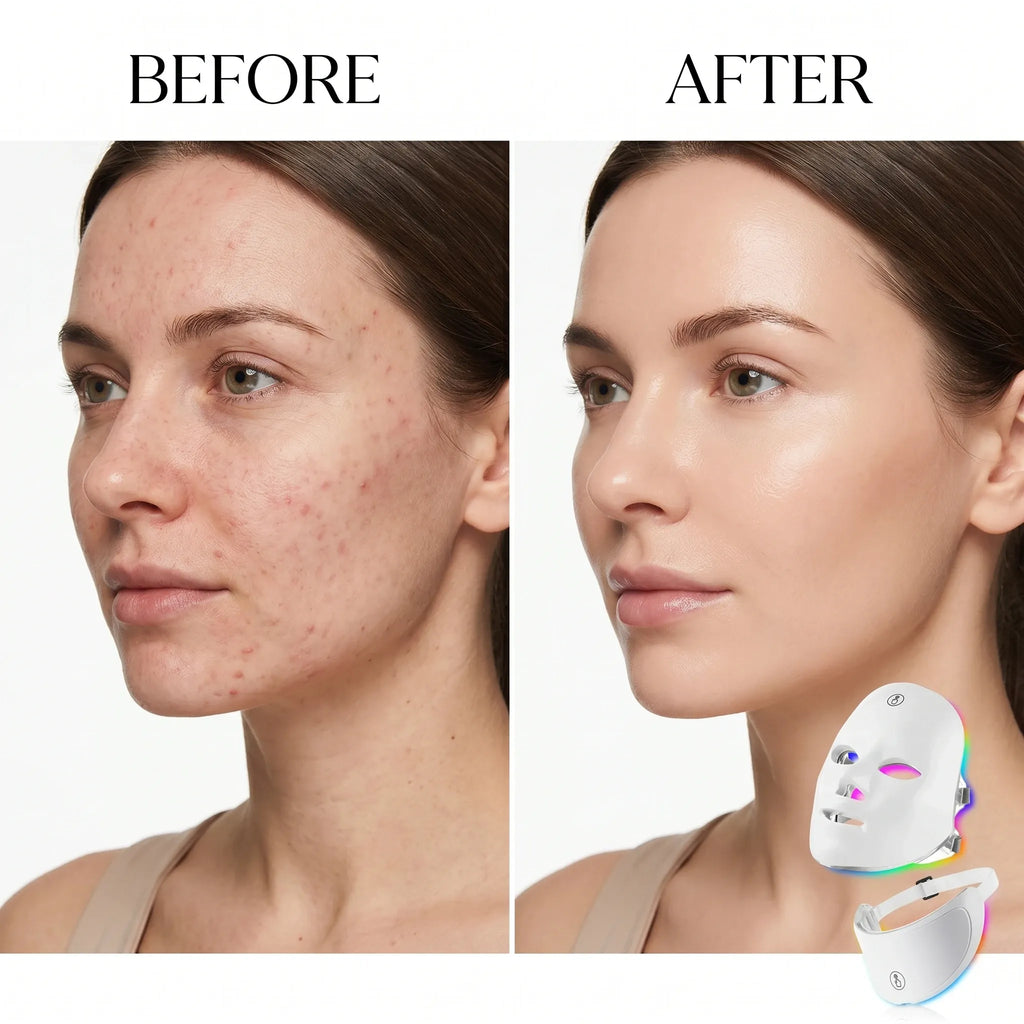 7-in-1 LED Light Therapy Face Mask — Anti-Aging, Acne & Glow